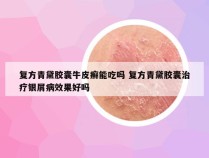 复方青黛胶囊牛皮癣能吃吗 复方青黛胶囊治疗银屑病效果好吗