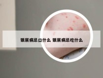 银屑病忌口什么 银屑病忌吃什么