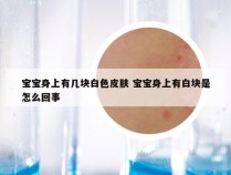 宝宝身上有几块白色皮肤 宝宝身上有白块是怎么回事