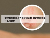 掌跎脓疱病什么方法可以止疼 掌跎脓疱病是什么引起的