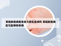 掌跖脓疱病是免疫力紊乱造成吗 掌跖脓疱病能引起哪些疾病