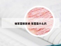 确苯霜银屑病 苯霜是什么药