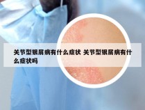 关节型银屑病有什么症状 关节型银屑病有什么症状吗