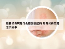 后背长白斑是什么原因引起的 后背长白斑是怎么回事