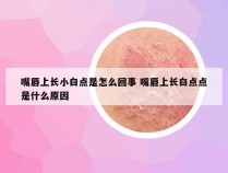 嘴唇上长小白点是怎么回事 嘴唇上长白点点是什么原因