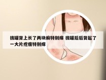 拔罐背上长了两块癣特别痒 拔罐后后背起了一大片疙瘩特别痒