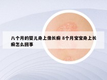 八个月的婴儿身上像长癣 8个月宝宝身上长癣怎么回事