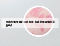 点滴型银屑病的注意事项 点滴型银屑病能自愈吗?