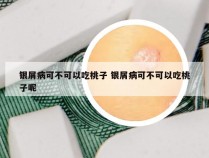 银屑病可不可以吃桃子 银屑病可不可以吃桃子呢