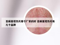 百癣夏塔热片那个厂家的好 百癣夏塔热片有几个品牌