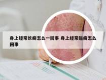 身上经常长癣怎么一回事 身上经常起癣怎么回事