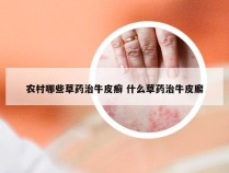 农村哪些草药治牛皮癣 什么草药治牛皮廨