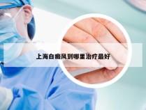 上海白癜风到哪里治疗最好