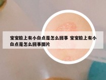 宝宝脸上有小白点是怎么回事 宝宝脸上有小白点是怎么回事图片