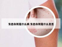 生态白斑是什么病 生态白斑是什么意思