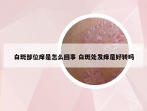 白斑部位痒是怎么回事 白斑处发痒是好转吗