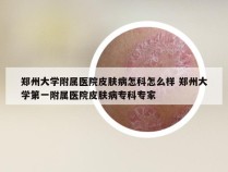 郑州大学附属医院皮肤病怎科怎么样 郑州大学第一附属医院皮肤病专科专家