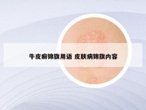 牛皮癣锦旗用语 皮肤病锦旗内容