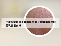 牛皮癣能用修正草本藓净 修正牌草本藓净抑菌乳膏怎么样