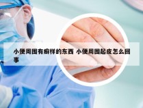 小便周围有癣样的东西 小便周围起皮怎么回事