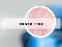 牛皮癣患者什么体质