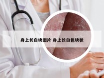 身上长白块图片 身上长白色块状