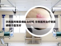 华西医院银屑病能治好吗 华西医院治疗银屑病哪个医生好