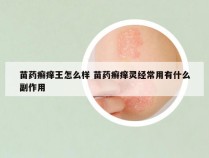 苗药癣痒王怎么样 苗药癣痒灵经常用有什么副作用