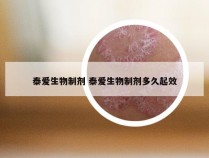 泰爱生物制剂 泰爱生物制剂多久起效