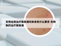 生物治剂治疗银屑病对身体有什么要求 生物制药治疗银屑病