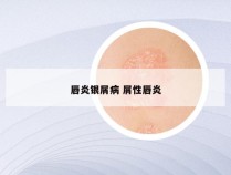 唇炎银屑病 屑性唇炎