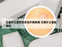 兰美抒儿童型软膏治疗银屑病 兰美抒儿童能用吗