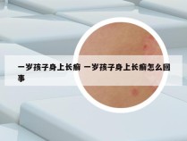 一岁孩子身上长癣 一岁孩子身上长癣怎么回事