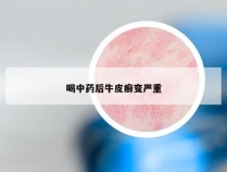 喝中药后牛皮癣变严重