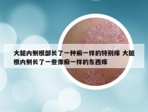 大腿内侧根部长了一种癣一样的特别痒 大腿根内侧长了一些像癣一样的东西痒