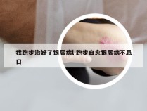 我跑步治好了银屑病l 跑步自愈银屑病不忌口