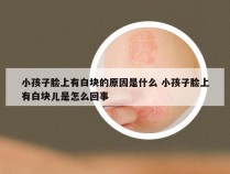 小孩子脸上有白块的原因是什么 小孩子脸上有白块儿是怎么回事