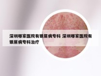 深圳哪家医院有银屑病专科 深圳哪家医院有银屑病专科治疗