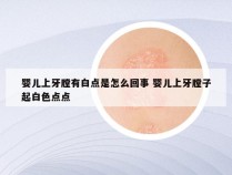 婴儿上牙膛有白点是怎么回事 婴儿上牙膛子起白色点点