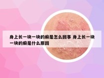 身上长一块一块的癣是怎么回事 身上长一块一块的癣是什么原因