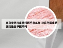 北京华医院皮肤科医院怎么样 北京华医皮肤医院是三甲医院吗