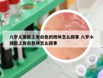 八岁儿童脸上有白色的斑块怎么回事 八岁小孩脸上有白色块怎么回事