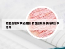 脓包型银屑病的病因 脓包型银屑病的病因不包括