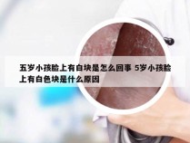 五岁小孩脸上有白块是怎么回事 5岁小孩脸上有白色块是什么原因