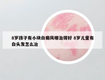 8岁孩子有小块白癜风哪治得好 8岁儿童有白头发怎么冶