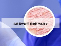 头藓长什么样 头癣长什么样子