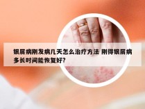 银屑病刚发病几天怎么治疗方法 刚得银屑病多长时间能恢复好?