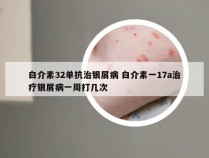 白介素32单抗治银屑病 白介素一17a治疗银屑病一周打几次