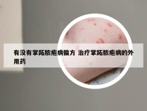 有没有掌跖脓疱病偏方 治疗掌跖脓疱病的外用药