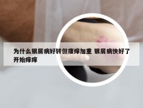 为什么银屑病好转但瘙痒加重 银屑病快好了开始痒痒